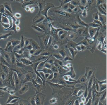 人膀胱上皮細(xì)胞HCV29/LUC(帶熒光素酶),HCV29/LUC