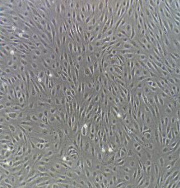 人霍奇金淋巴瘤細(xì)胞HDLM2/LUC(帶熒光素酶),HDLM2/LUC