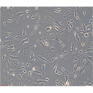 人甲狀腺癌細(xì)胞8505C/LUC(帶熒光素酶)