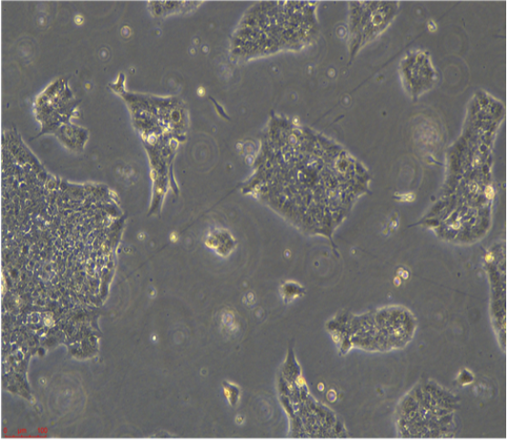 UACC-2087/LUC(帶熒光素酶),uacc2087/LUC