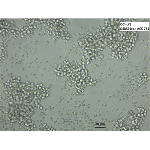 NCI-H720[H720]/LUC(帶熒光素酶),ncih720/LUC