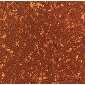 RERF-LC-MS/LUC(带荧光素酶)