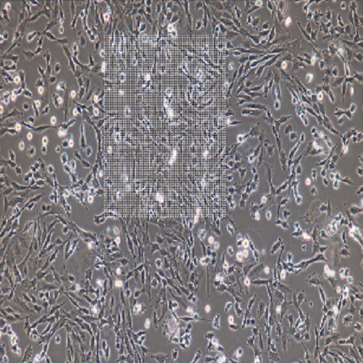 OCM1A/RFP人眼脉络黑色素瘤细胞带红色荧光,OCM1A/RFP