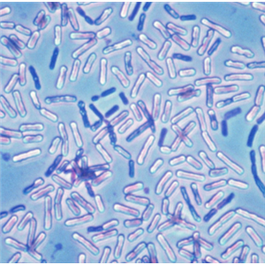 Mucor Hiemalis F. Corticola