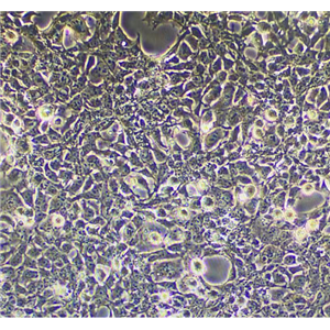 Lu-134-A(LU-134-A-H)  ATCC細(xì)胞,lu134alu134ah