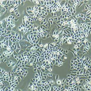 人乳腺癌细胞带绿色荧光MCF-7/GFP,MCF7/GFP