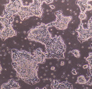 人結(jié)腸癌細(xì)胞帶綠色熒光HT-29/GFP,HT29/GFP