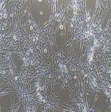 hela/GFP人宫颈癌细胞带绿色荧光,hela/GFP