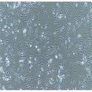 人骨肉瘤細(xì)胞帶綠色熒光U-2OS/GFP