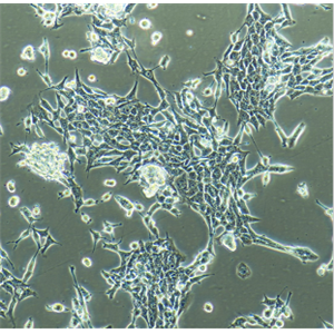 人卵巢癌腺癌細(xì)胞帶綠色熒光NIHOVCAR-3/GFP