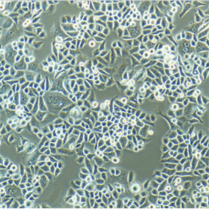 人乳腺癌细胞带绿色荧光MCF-7/GFP