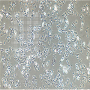 人乳腺導(dǎo)管癌細胞ZR7530,ZR7530