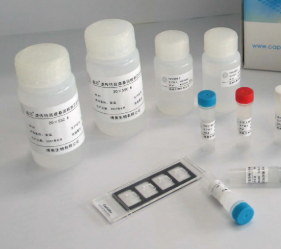 禽類肉瘤病毒染料法熒光定量RT-PCR試劑盒Avian Sarcoma Virus(ASV)