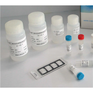 禽类肉瘤病毒染料法荧光定量RT-PCR试剂盒Avian Sarcoma Virus(ASV)