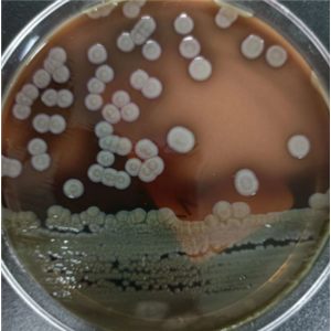 Lichtheimia Corymbifera,Lichtheimia Corymbifera