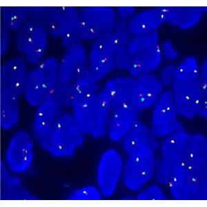 辰輝創(chuàng)聚生物Nebulabio熒光原位雜交探針,Nebulabio FISH Probes