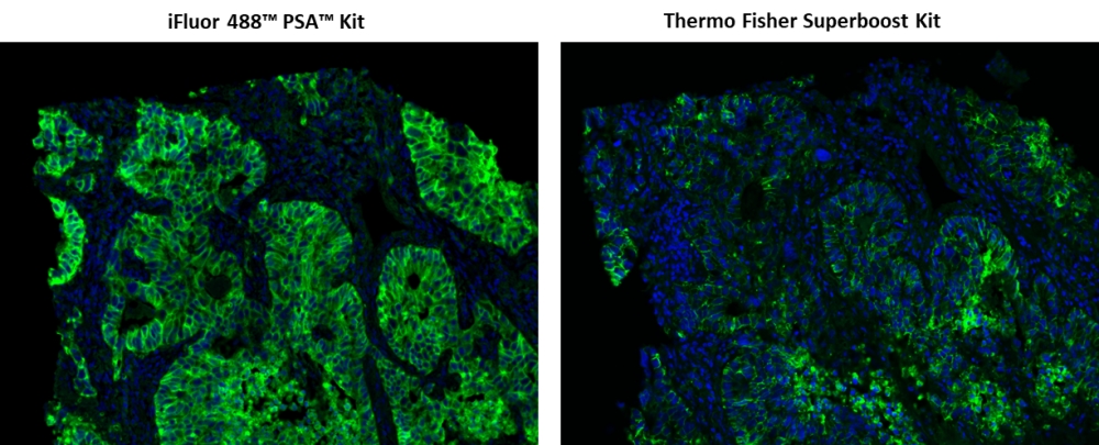 iFluor 488 酪胺信號放大成像試劑盒，含有山羊抗兔IgG,iFluor? 488 PSA? Imaging Kit with Goat Anti-Rabbit IgG