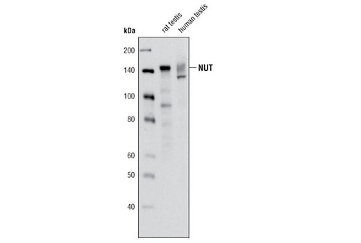 NUT (C52B1) 兔單克隆抗體,NUT (C52B1) Rabbit mAb