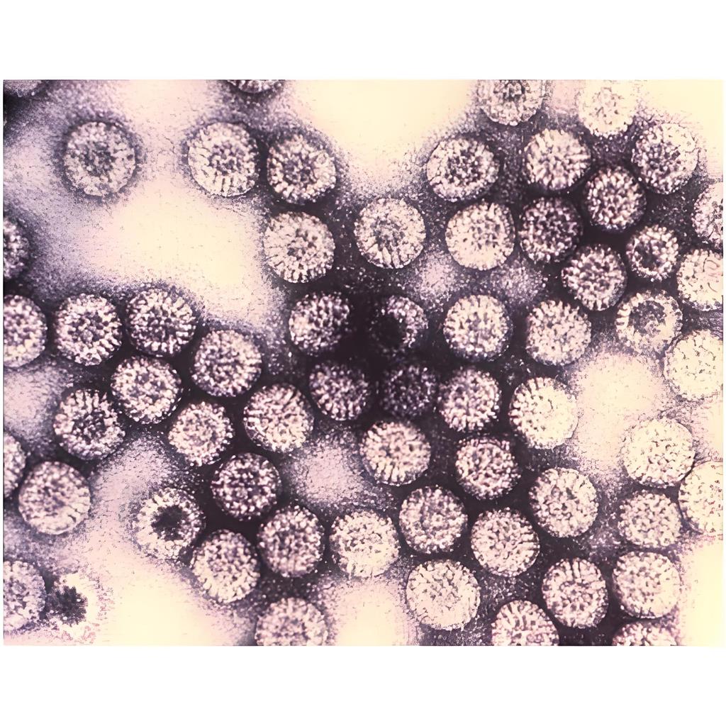 貓細(xì)小病毒（FPV)單克隆抗體；貓細(xì)小病毒抗體,Monoclonal antibodies against Toxoplasma and  virus