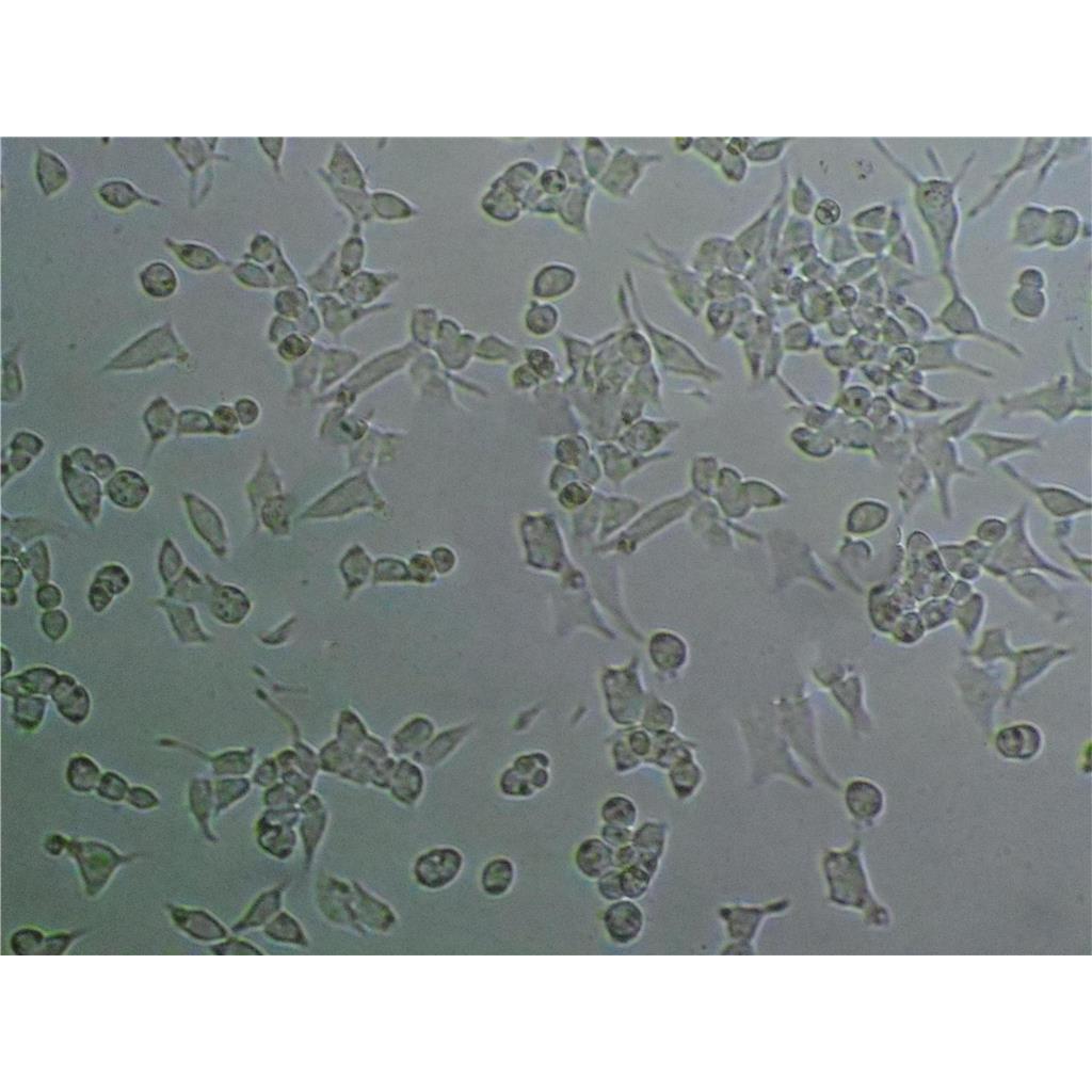 HPAC Cells人胰腺腺泡上皮癌細(xì)胞系(提供STR圖譜),HPAC Cells