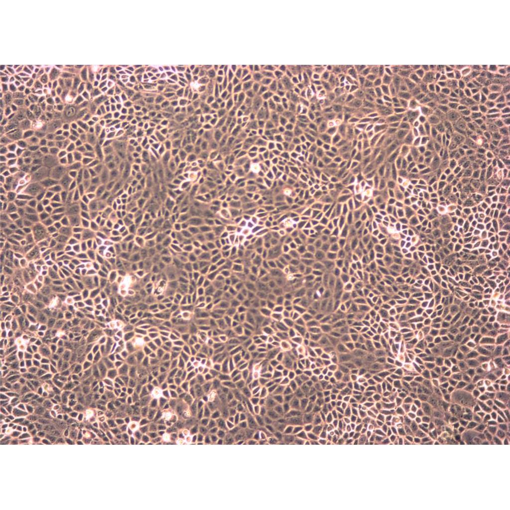 BC-3 Cells人淋巴瘤細(xì)胞系,BC-3 Cells