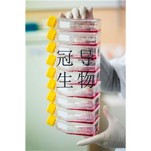 SU-DHL-4 Cells人B淋巴瘤細(xì)胞系,SU-DHL-4 Cells