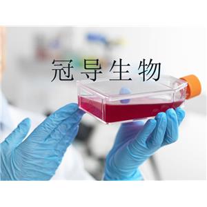 NTERA-2 Cells人惡性多發(fā)性畸胎瘤細胞系,NTERA-2 Cells