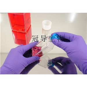 NCI-H3122 Cells人非小细胞肺癌细胞系(提供STR图谱),NCI-H3122 Cells