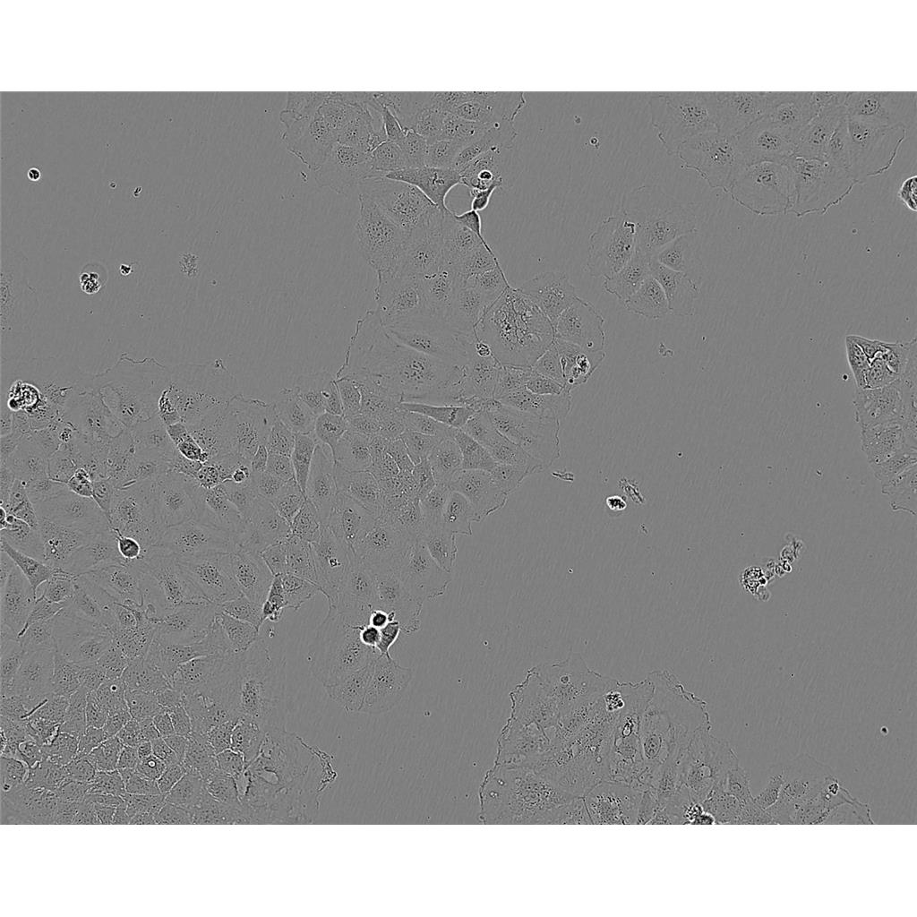 TOLEDO Cells人彌漫大B細胞淋巴瘤細胞系,TOLEDO Cells