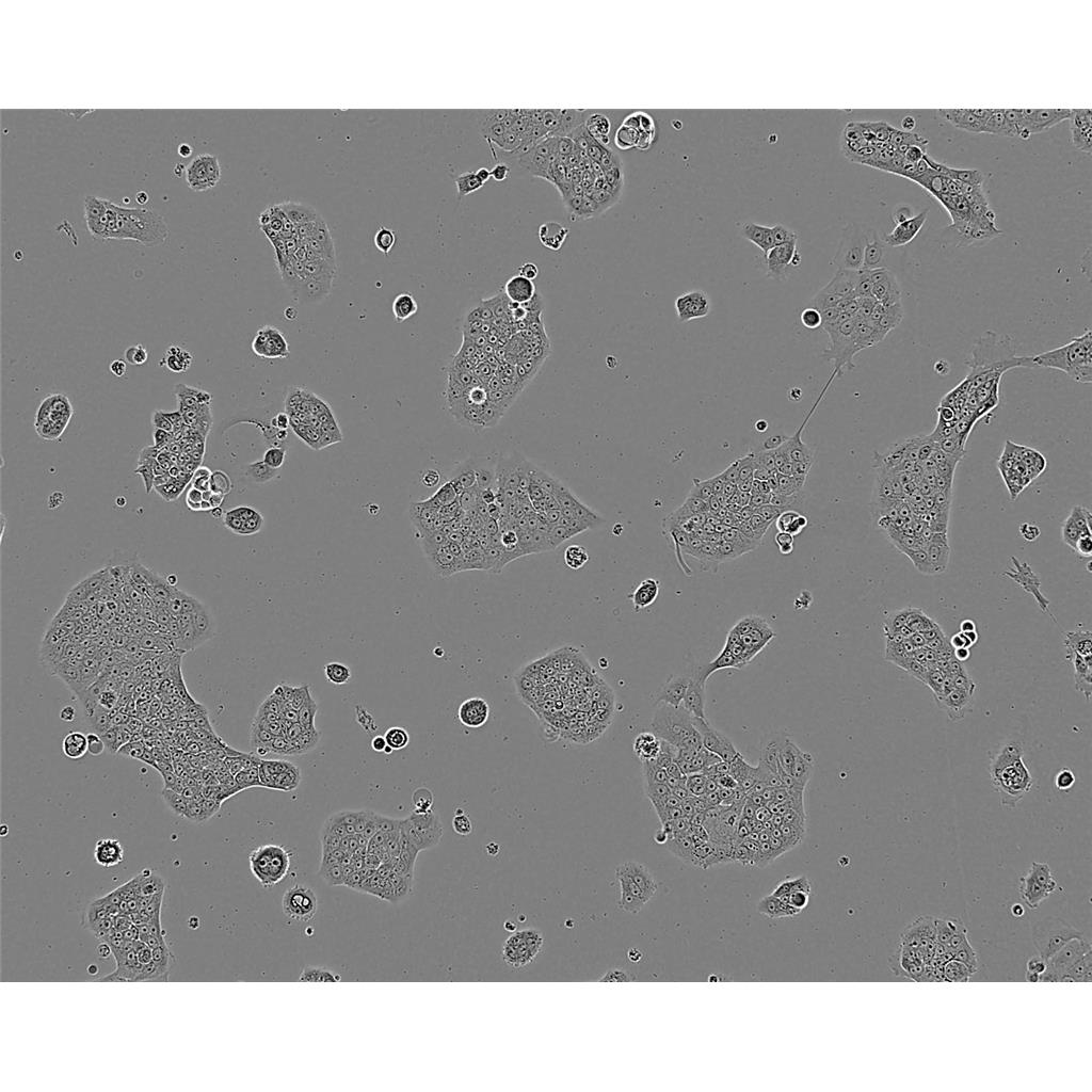 12Z Cells人子宮內(nèi)膜異位上皮細(xì)胞永生化細(xì)胞系,12Z Cells