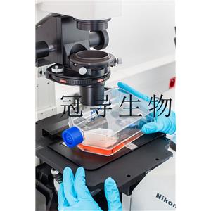 IOMM-Lee Cells人腦膜瘤細(xì)胞系,IOMM-Lee Cells