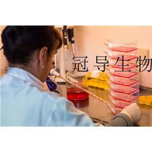 MCF-12A Cells人乳腺上皮細(xì)胞系,MCF-12A Cells