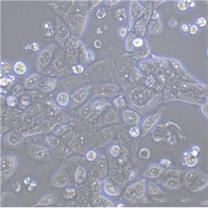 Karpas-299 Cells人间变性大细胞淋巴瘤细胞系(提供STR图谱)