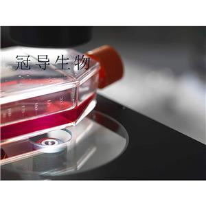 HuH-1 Cells人肝癌細(xì)胞系,HuH-1 Cells