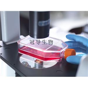 Jiyoye Cells人B淋巴细胞系(提供STR图谱),Jiyoye Cells