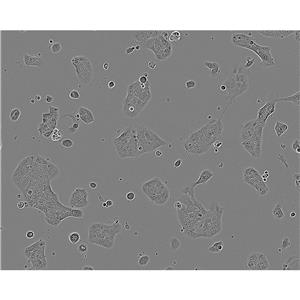 K7M2 wt[K7M2-WT] Cells小鼠骨肉瘤成骨细胞系(提供STR图谱)