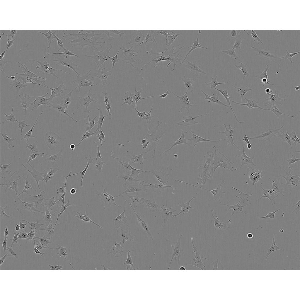 WM115 Cells人惡性黑色素瘤細(xì)胞系,WM115 Cells