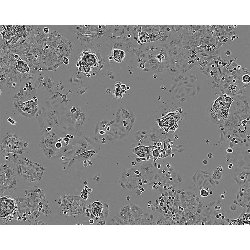 NCI-H1993 Cells人非小細(xì)胞肺癌腺癌細(xì)胞系,NCI-H1993 Cells