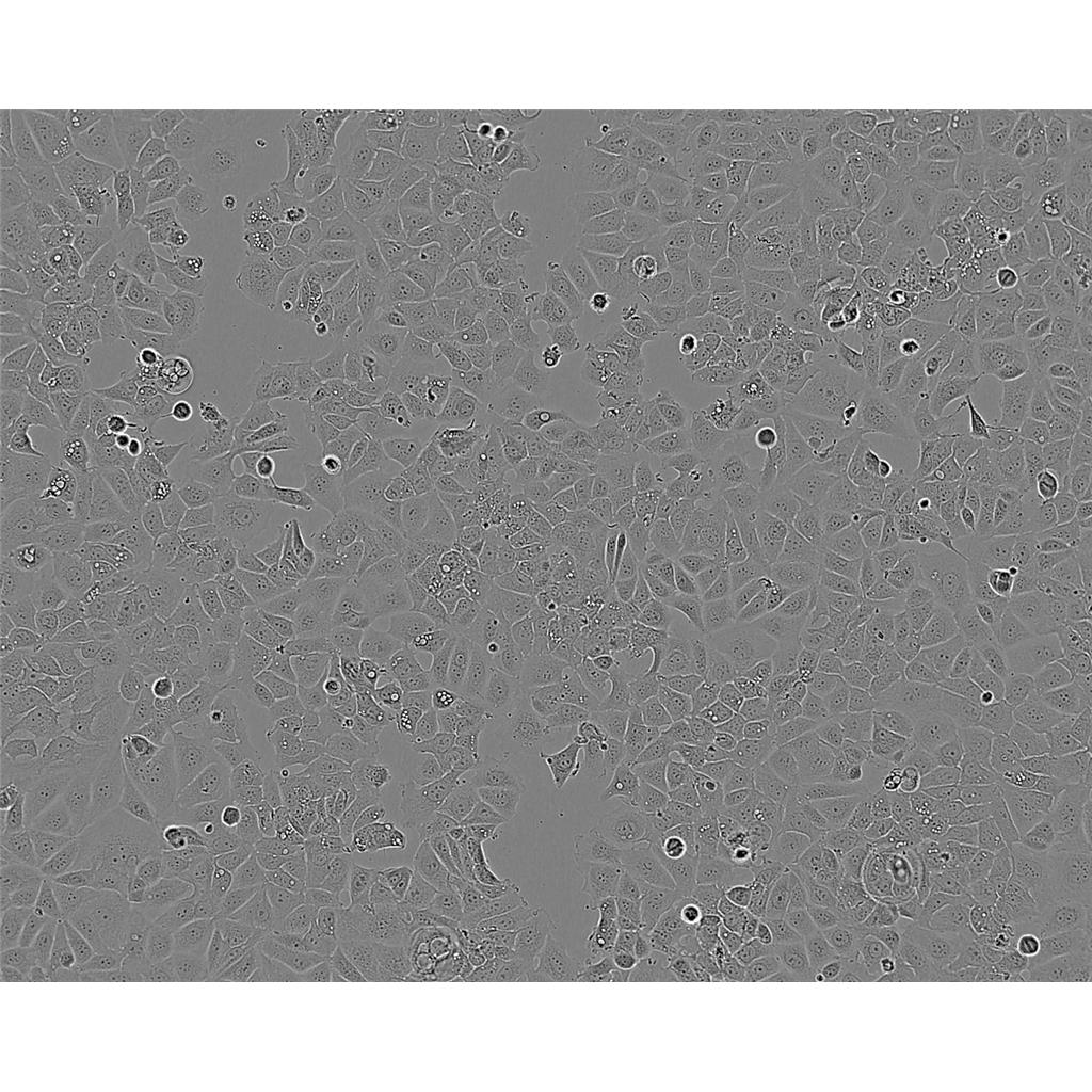 SKNO-1 Cells人急性髓系白血病細胞系,SKNO-1 Cells