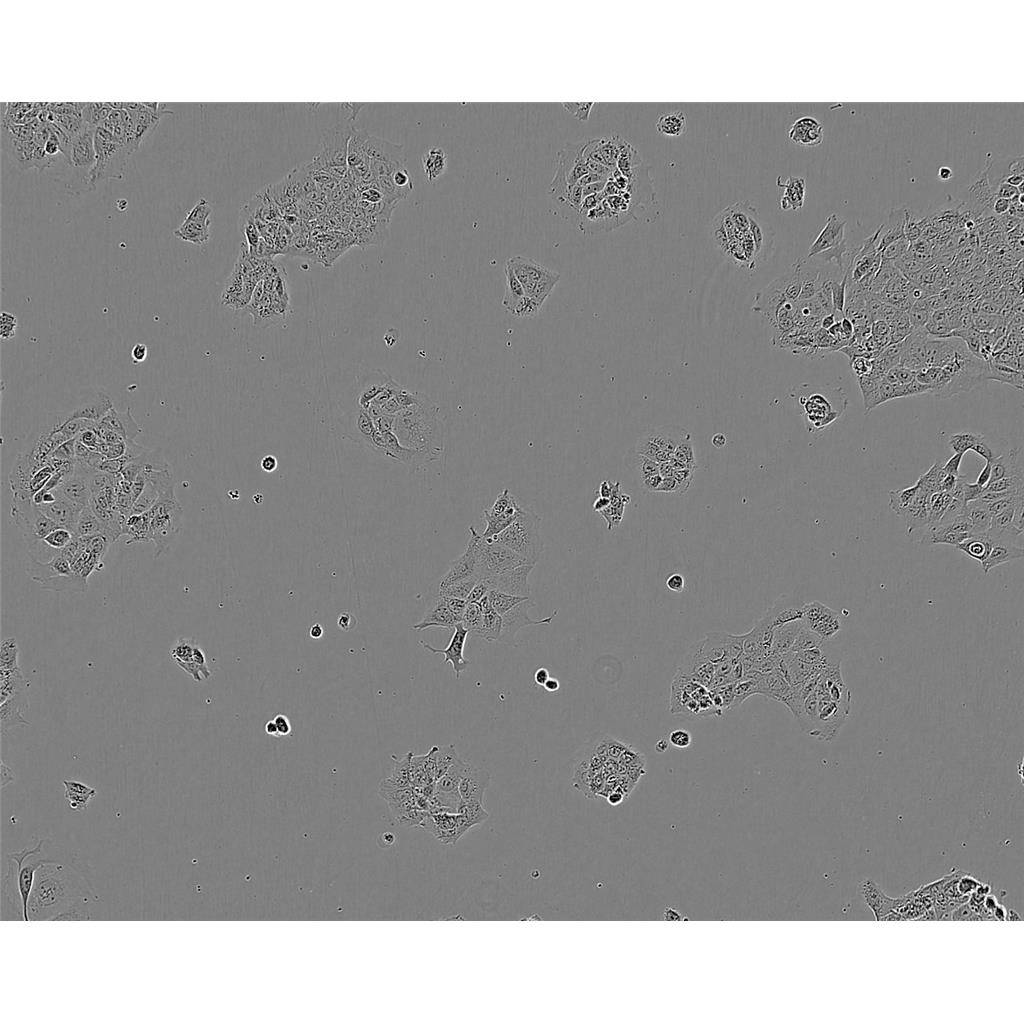 GCT Cells人巨細胞瘤細胞系,GCT Cells