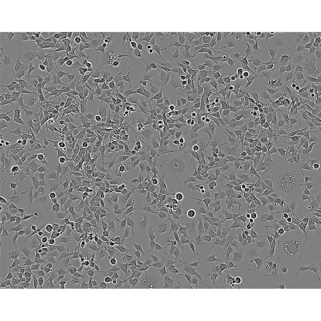 NCI-H187 Cells人小細(xì)胞肺癌細(xì)胞系(提供STR圖譜),NCI-H187 Cells