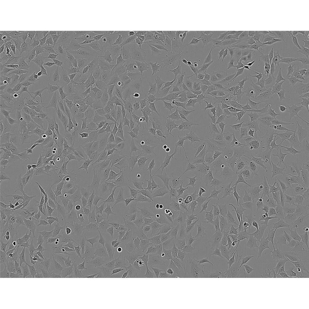 HSC-T6 Cells大鼠肝星形細(xì)胞系,HSC-T6 Cells