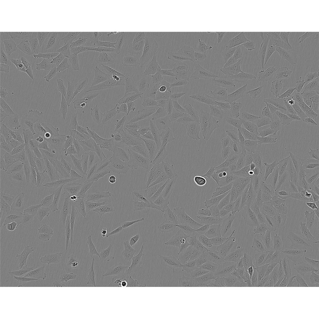 B104 Cells大鼠神經(jīng)母細胞瘤細胞系,B104 Cells