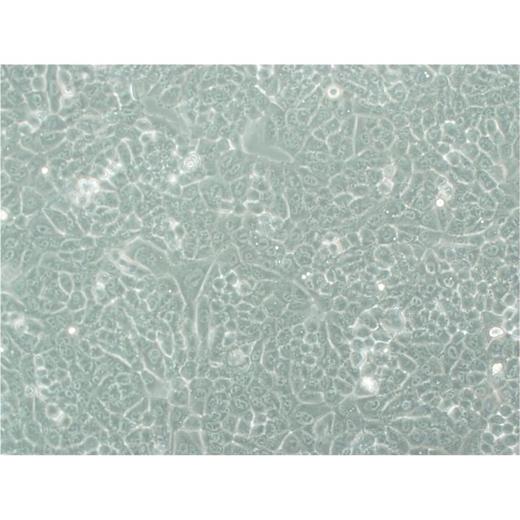 P815 Cells小鼠肥大細(xì)胞瘤細(xì)胞系,P815 Cells