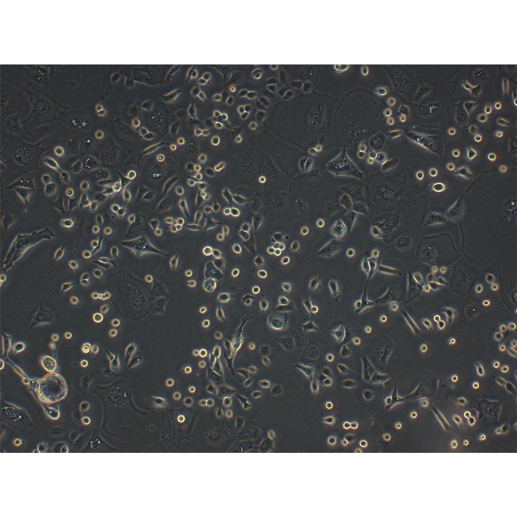 B16-F0 Cells小鼠黑色素瘤細胞系,B16-F0 Cells