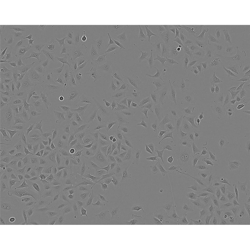 NCI-H508 Cells人結(jié)腸直腸腺癌細(xì)胞系,NCI-H508 Cells