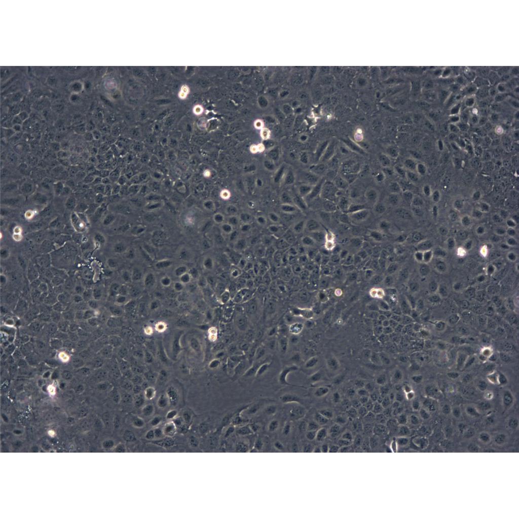 NCI-H460 Cells人大細(xì)胞肺癌細(xì)胞系,NCI-H460 Cells