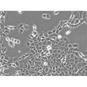 DoHH2 Cells人B细胞淋巴瘤细胞系(提供STR图谱)