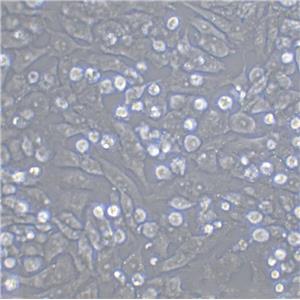 CCRF-SB Cells人外周血淋巴細(xì)胞系,CCRF-SB Cells