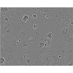 NCI-H1993 Cells人非小细胞肺癌腺癌细胞系(提供STR图谱)